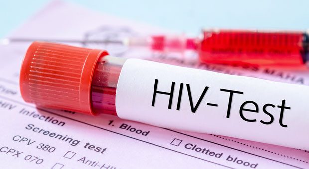 Europe sees rising in HIV cases !