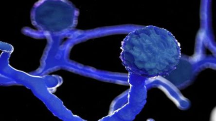 The ‘black fungus’ maiming Covid patients in India
